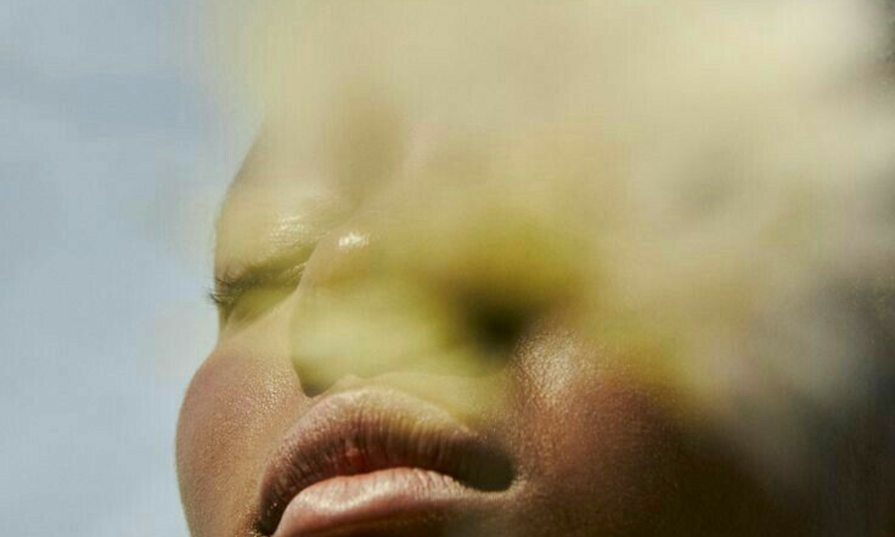 Post-Sun Repair: The Calming Ritual To Soothe And Restore Holiday Skin Damage