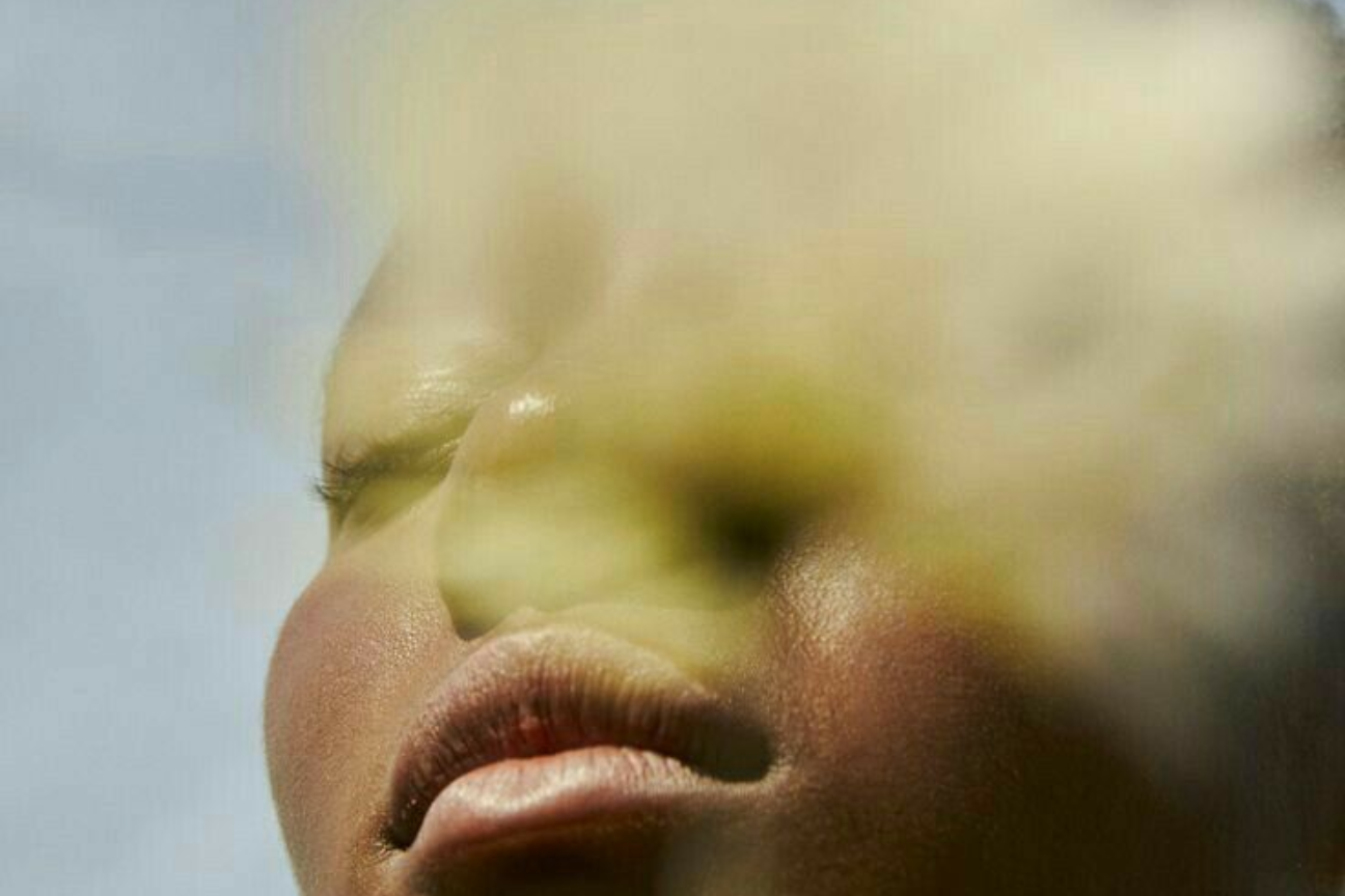 Post-Sun Repair: The Calming Ritual To Soothe And Restore Holiday Skin Damage