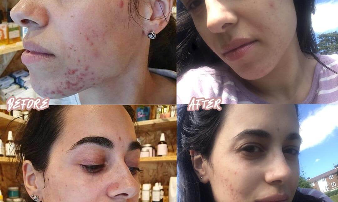 Wow look at these incredible results!