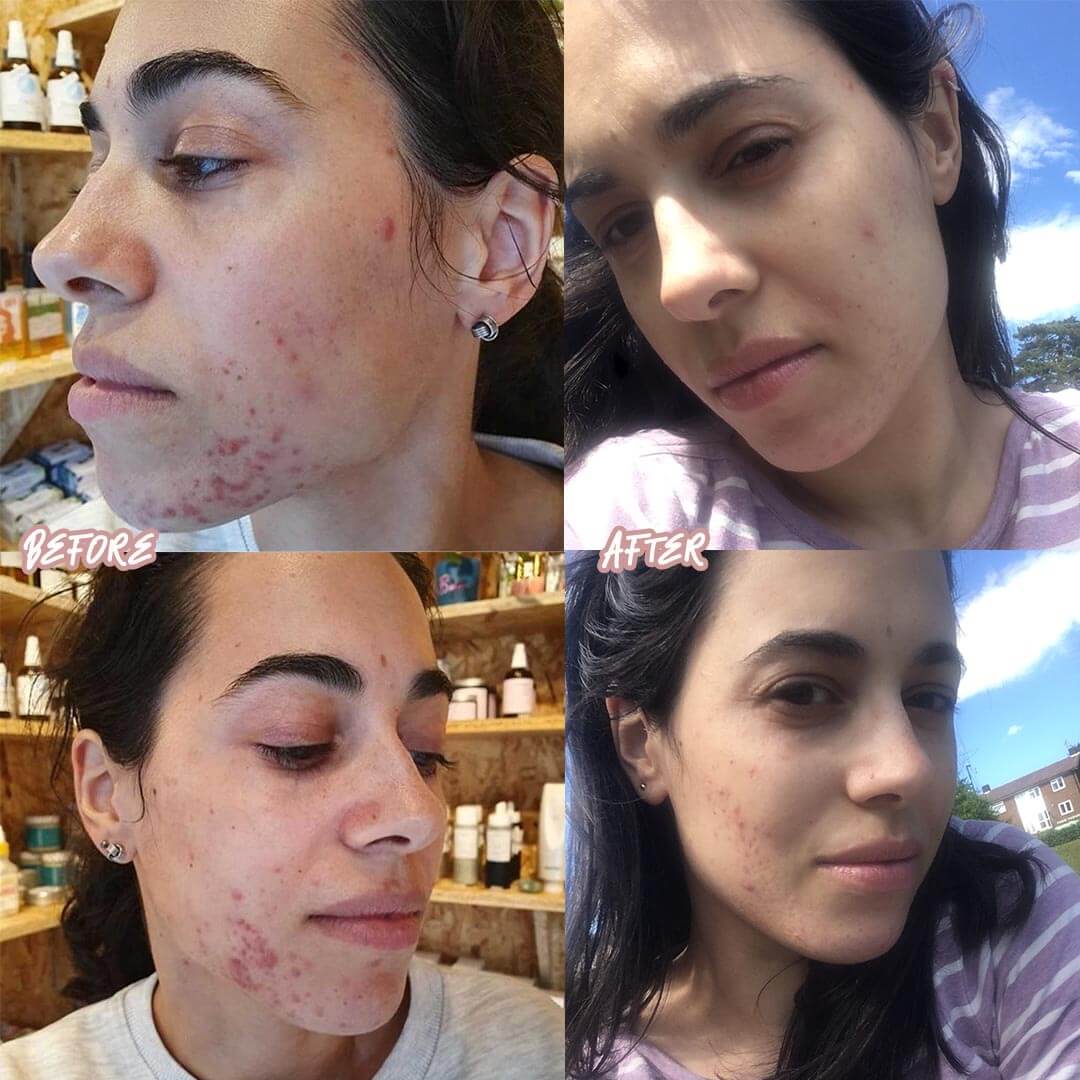 Wow look at these incredible results!