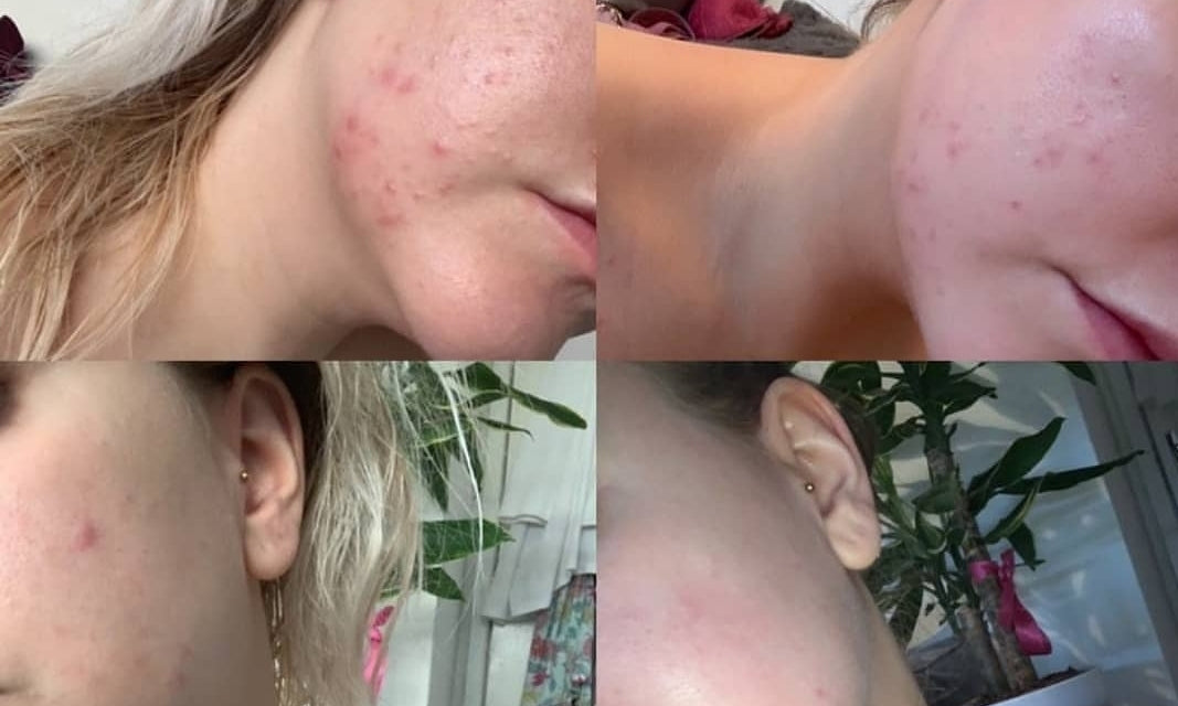 NINI Organics: Tasha's 1-Week Skin Glow Transformation
