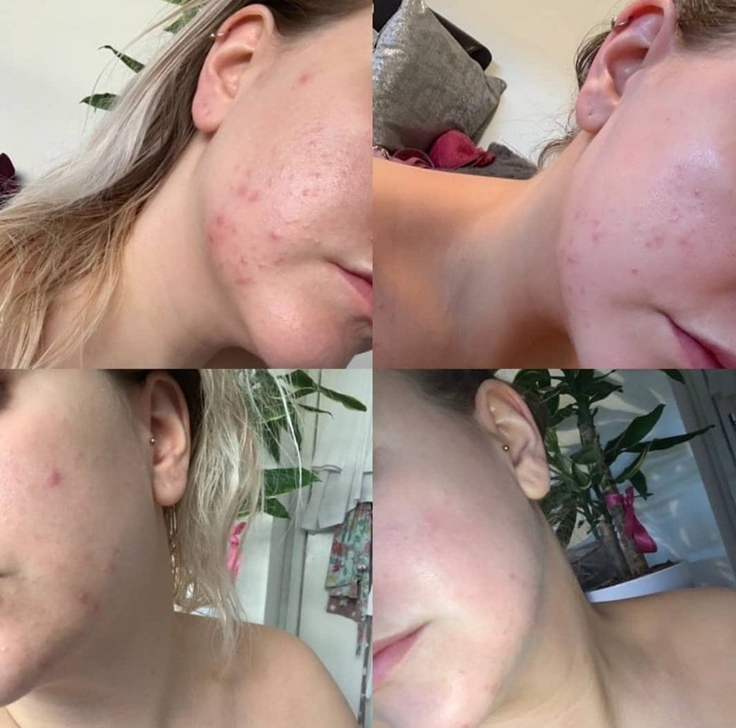 NINI Organics: Tasha's 1-Week Skin Glow Transformation