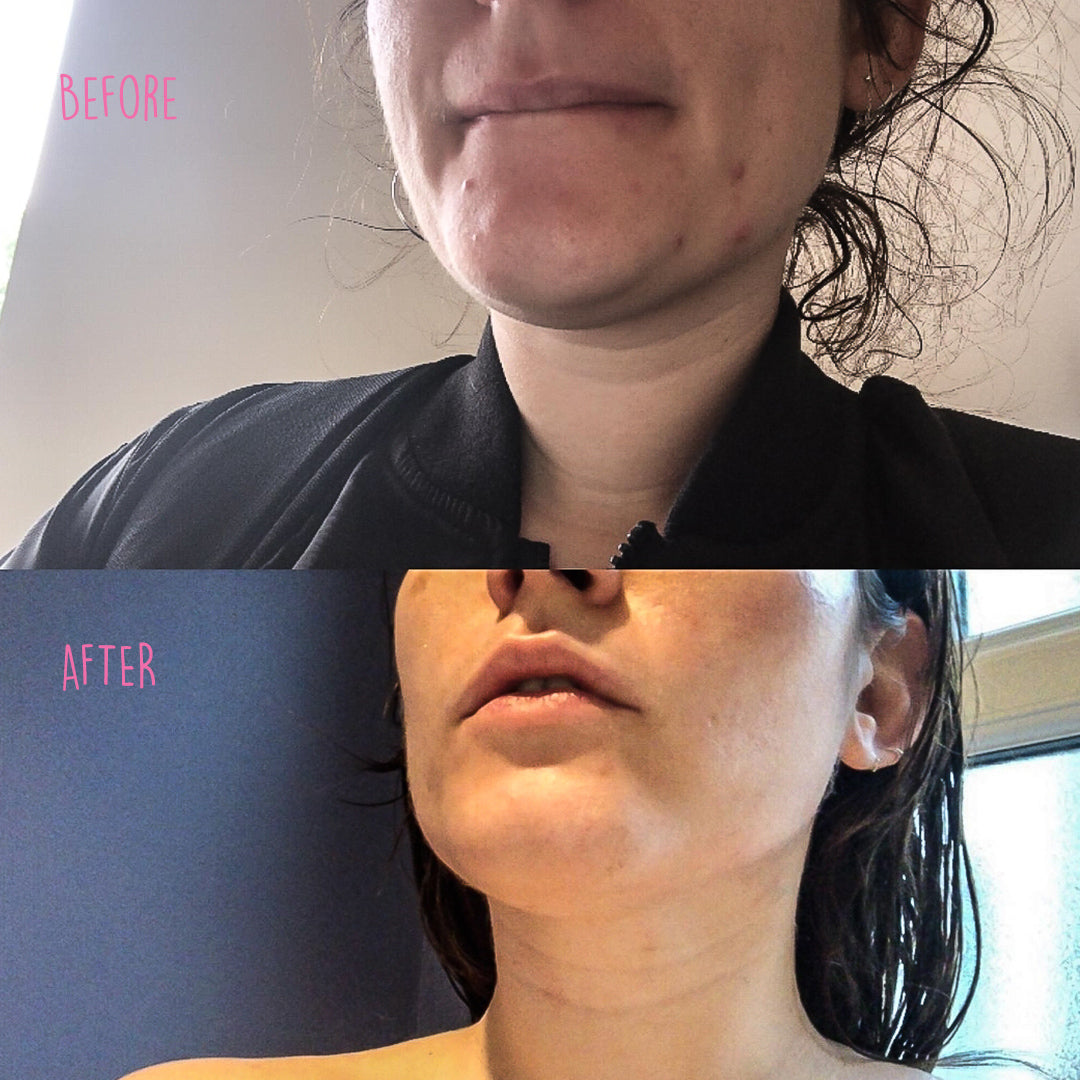 How the Natura Range Changed My Skin